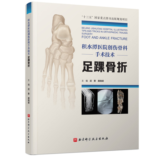 新书推荐 | 积水潭医院创伤骨科手术技术-足踝骨折,一本按图索骥的工具书
