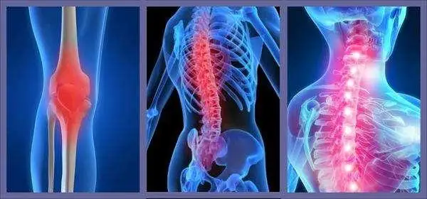 中轴型脊柱关节炎的管理建议（内含治疗流程图）