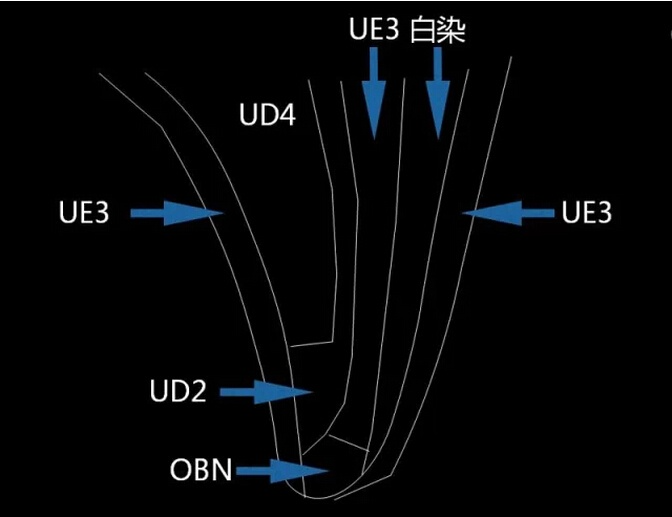 做好前牙树脂修复，你需要了解的基本功