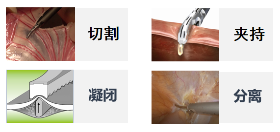 如何合理使用超声刀?这篇文章讲清楚了