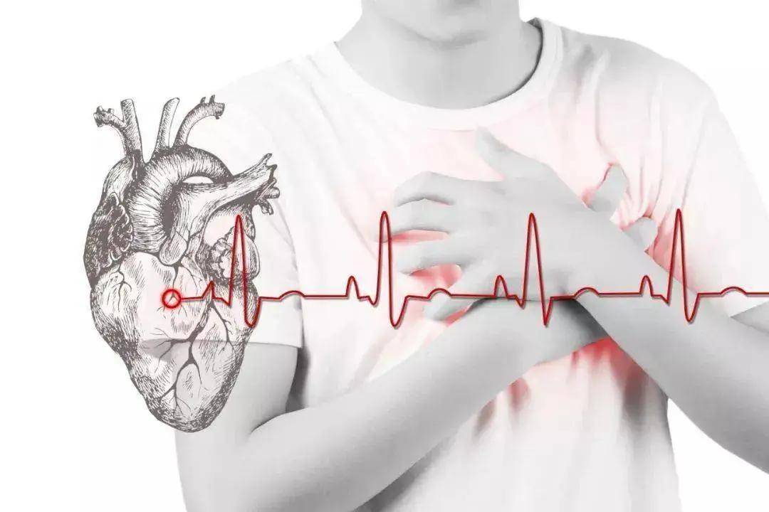 心律失常——房颤患者的紧急处置