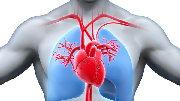 心肌桥到底是什么？需要治疗吗？