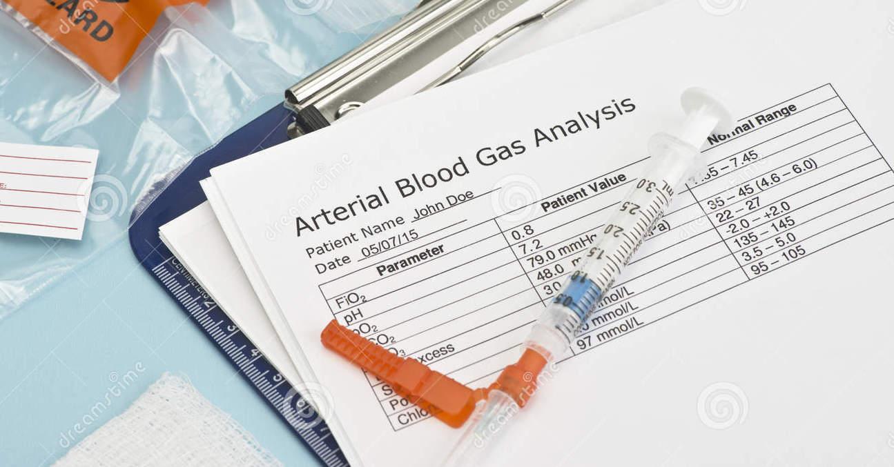动脉血气分析的采集与结果解读