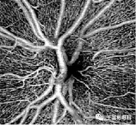 来自OCTA的观点，如何分离识别视网膜的4层毛细血管网