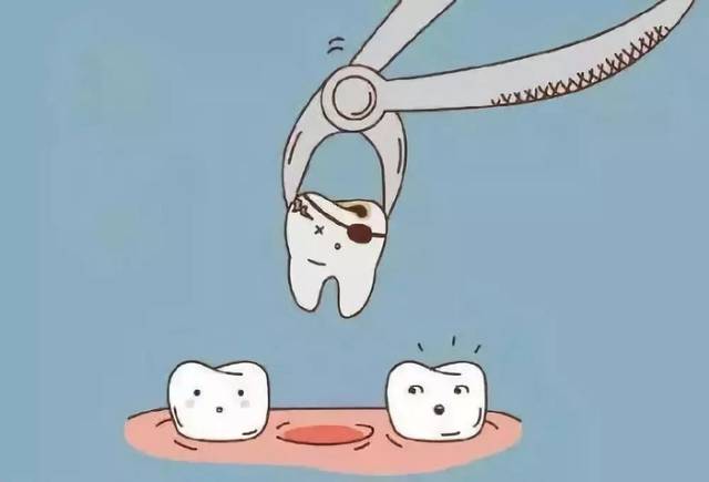 恒牙拔除术临床操作规范