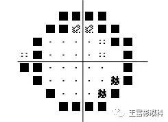 视野检查时出现的“学习效应现象”及解决的办法