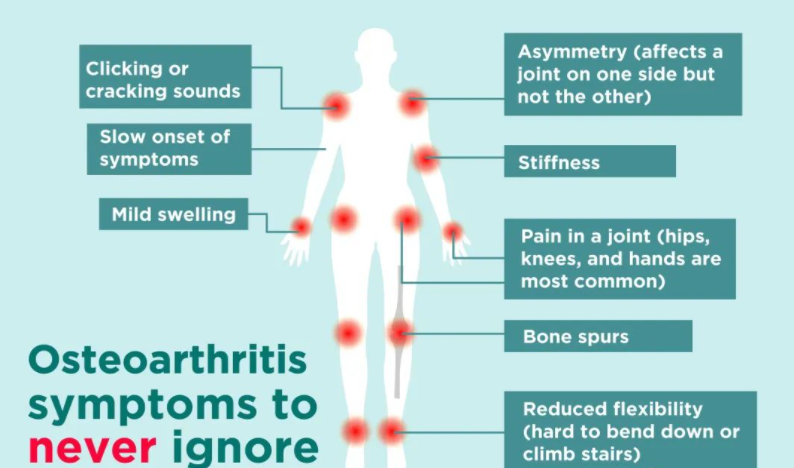 与炎性关节炎对比，你可能忽略的10种骨性关节炎症状