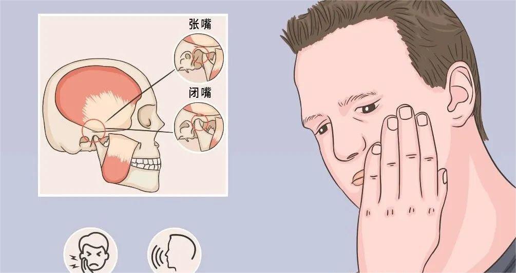 口腔颌面外科学：颞下颌关节脱位