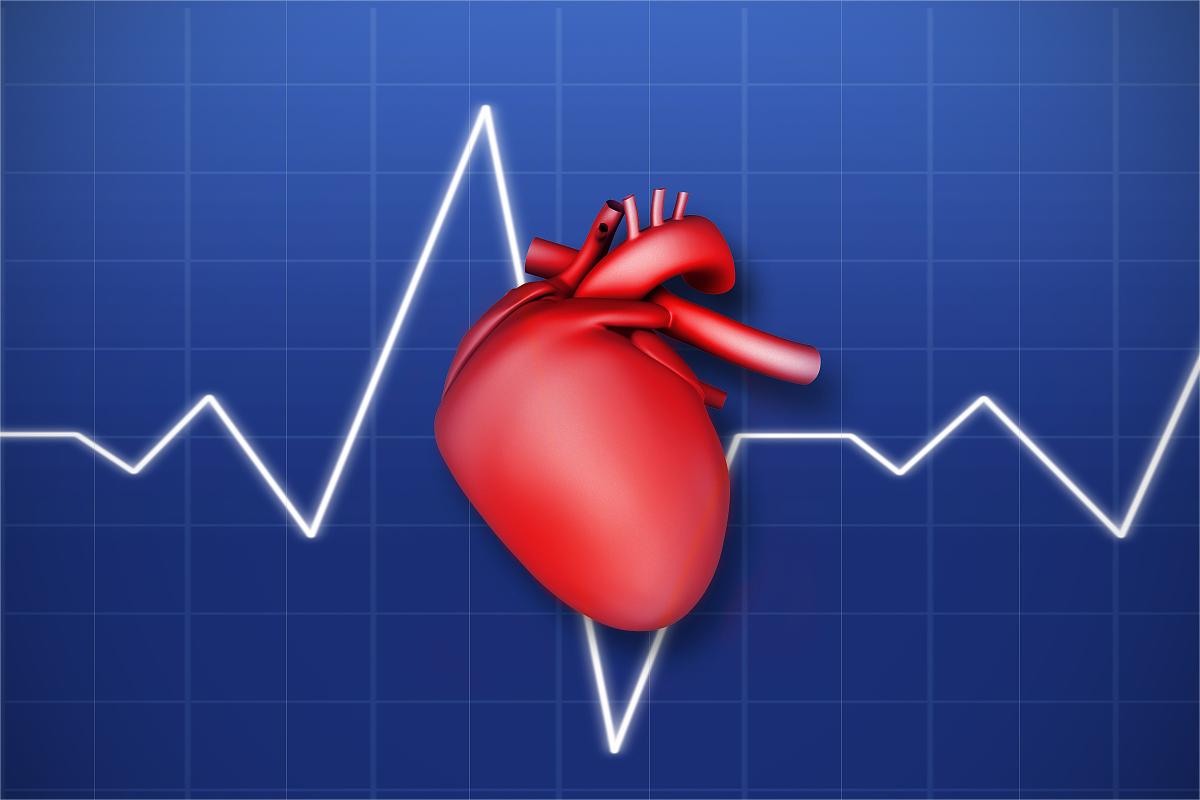 ICU常见恶性心律失常心电图的识别与处理