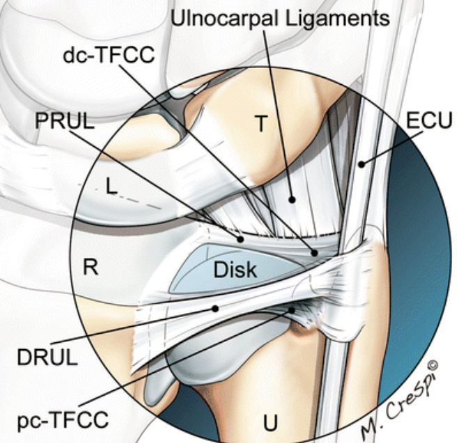 三角纤维软骨复合体（TFCC）之痛