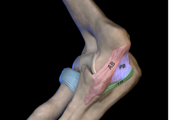 肘关节后内侧旋转不稳PMRI