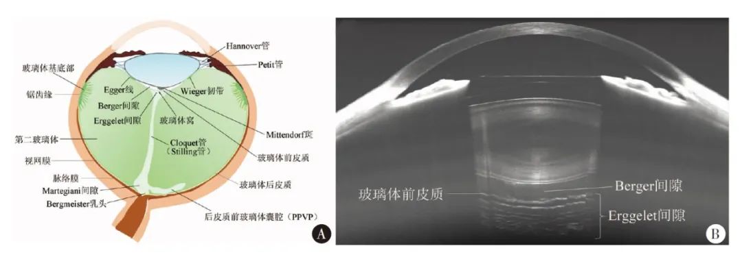 玻璃体间隙及临床应用