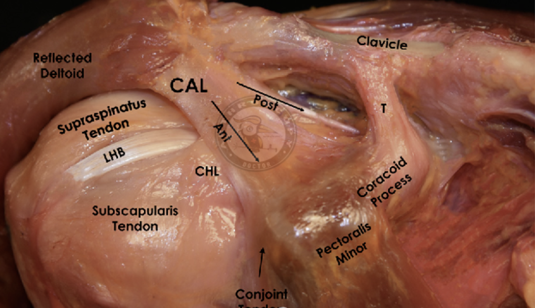 早读 | 【手术理念】喙肩韧带(CAL)你真的了解过吗？