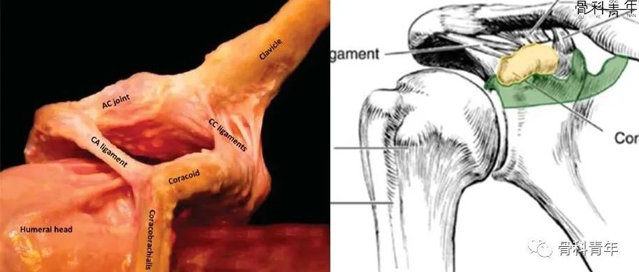 肩关节“灯塔”｜喙突骨折的解剖、分型与治疗