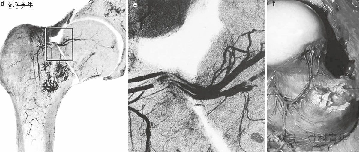 深度总结：股骨头的血液供应、应用解剖和相应外科实践