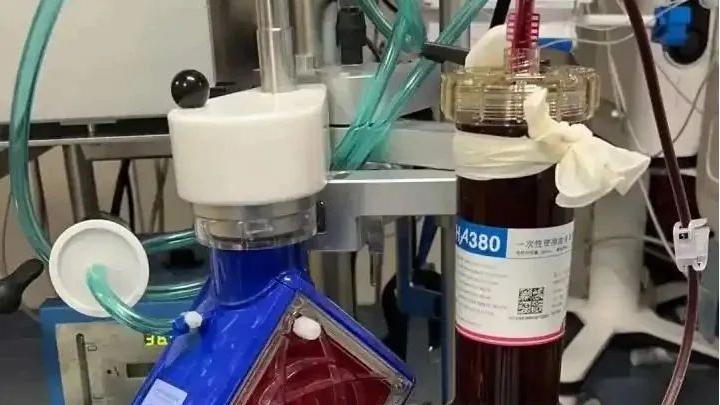 心肌炎在什么情况下需要使用ECMO