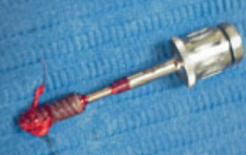 忘调转速,植体撕裂神经