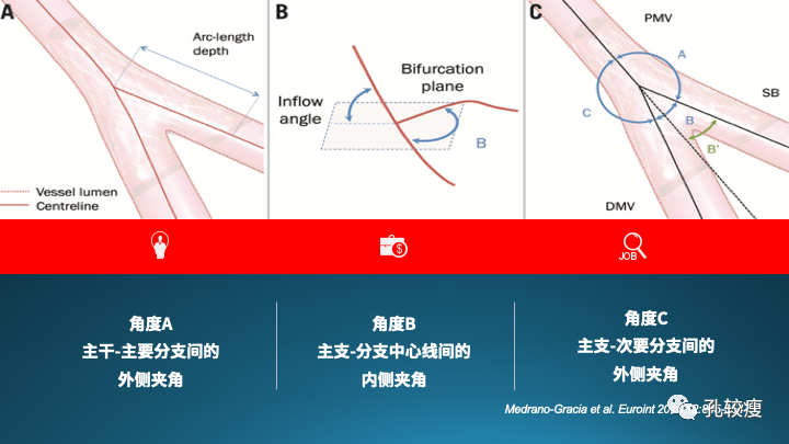 为什么说左主干是一个特殊的分叉