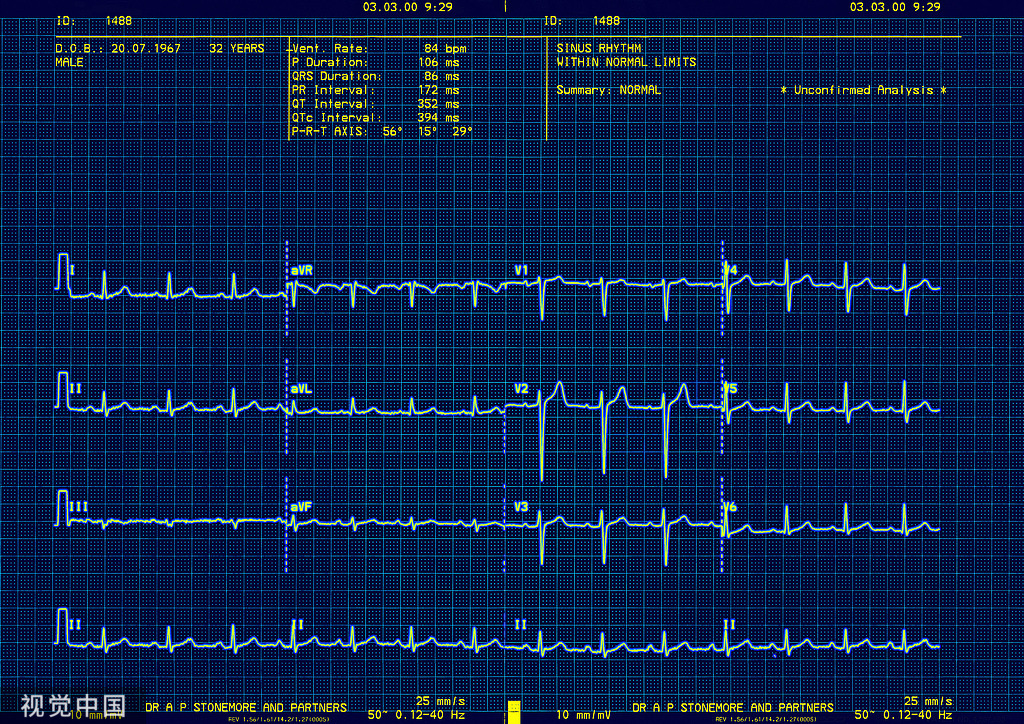 急性心肌梗死（STEMI）心电图（ECG）演变
