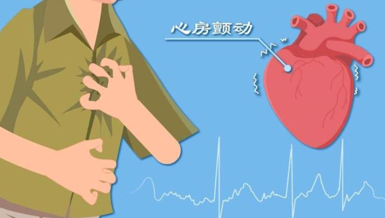 中国心房颤动管理：2025最新指南推荐，速览！