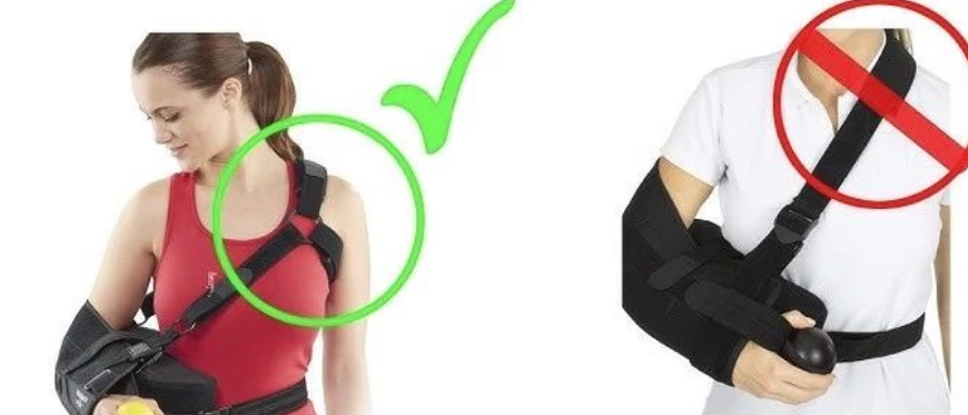 手术理念 | 肩袖修补术后需要肩关节外展支具？