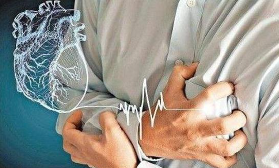 急性房颤如何处理？超实用干货