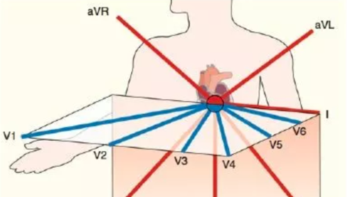 心电图总是记不住?这些基础知识一定要掌握!