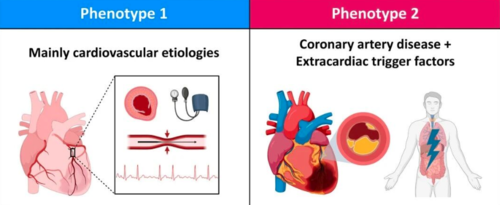 1型心肌梗死和2型心肌梗死的区别