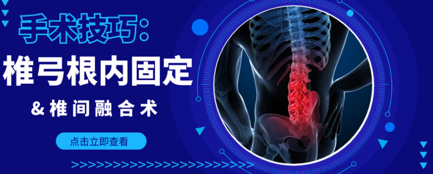 腰椎椎弓根内固定+椎间融合术，手术技巧全解析！