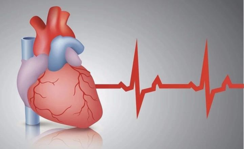 完全性右束支阻滞(CRBBB)的诊断标准
