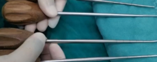 快准稳置入腰椎椎弓根螺钉,这些方法技巧你都掌握了吗?