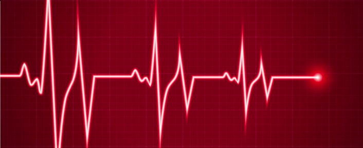 极易误诊为室性心动过速的几种情况