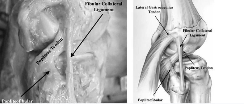 膝关节后外侧复合体