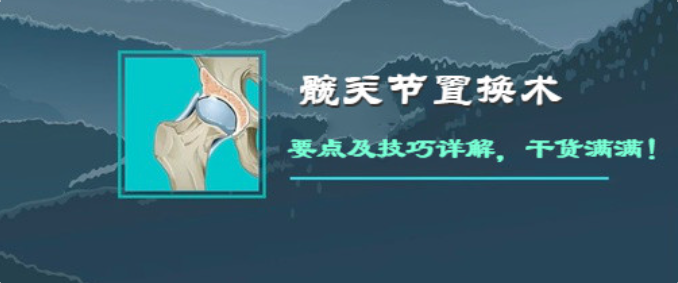 如何做好人工髋关节置换术？这篇全是干货！