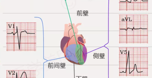 心律失常——房颤患者的紧急处置