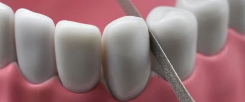 邻面去釉不能随便做，这几点你应该知道！