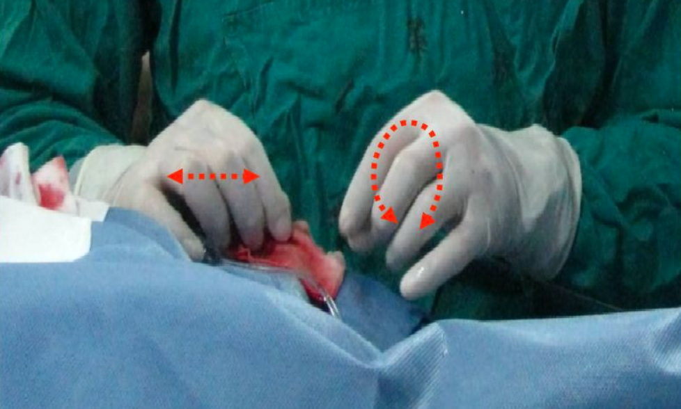 【超详细】介入导丝操作教程，心血管医生基础必备！