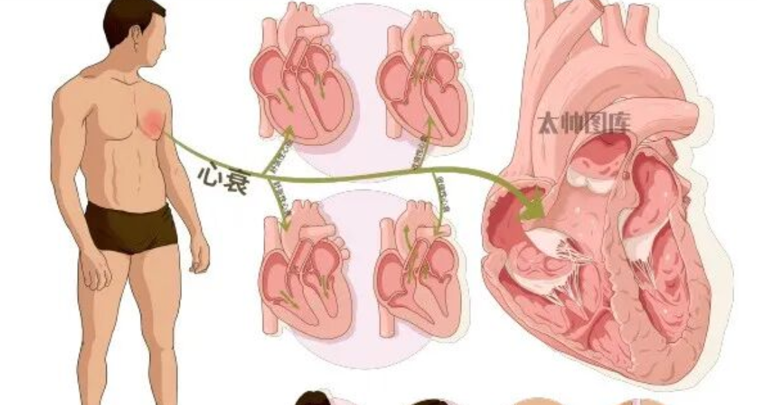 关于心衰诊断标志物—BNP，总结全了