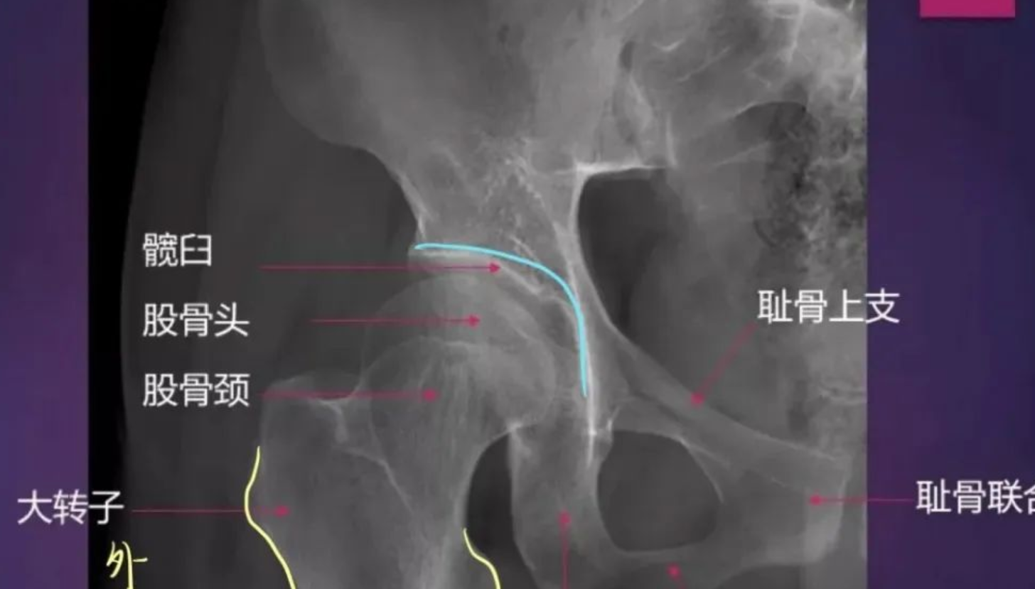 四肢骨骼影像解剖，一文掌握！