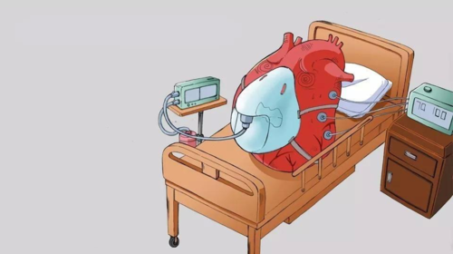 最新中国(射血分数保留的心衰)HFpEF共识更新,诊疗新进展一文解读