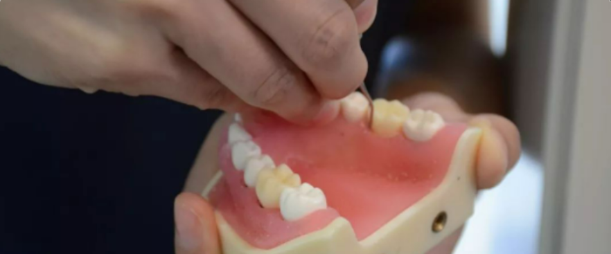 牙周刮治技术，从检查到操作方法，全套要点总结！