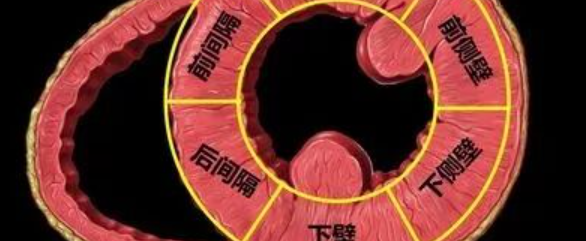 12导、15导、18导连接示意图及心脏各壁超声解剖位置与心电图导联对应关系