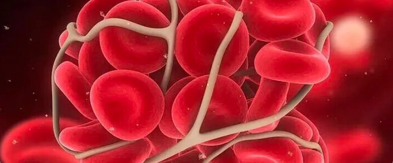 冠脉支架术后还需要静脉抗凝吗？