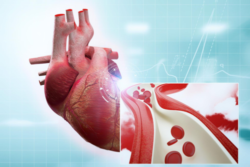 抗血小板治疗中国专家共识