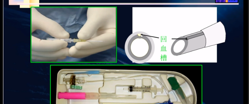 桡动脉穿刺技巧，你要知道的细节都在这！