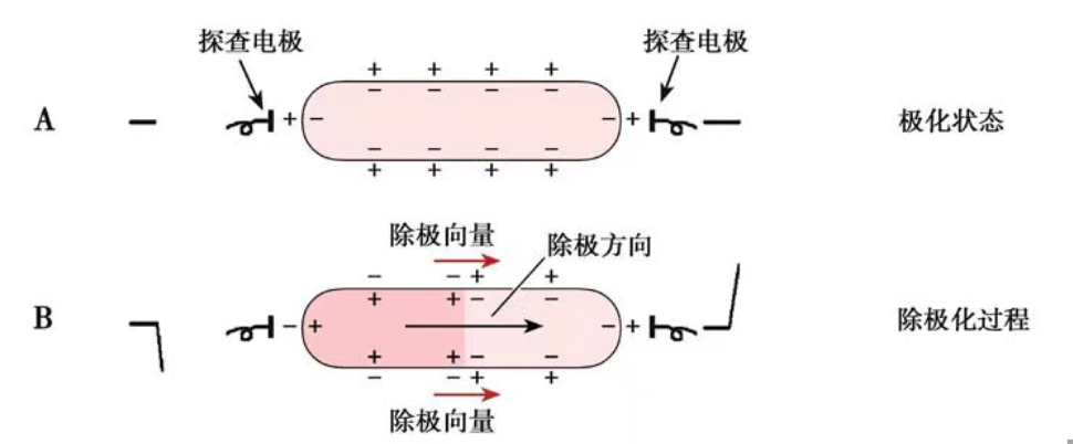 ​9 张实例，吃透急性心梗心电图！