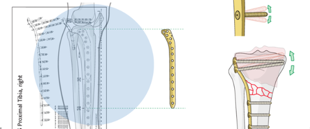 【盘点】钢板的分类与6大功能，实在全面！