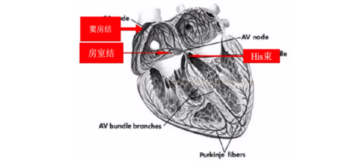 心律解码丨急诊心律失常的诊断及处理