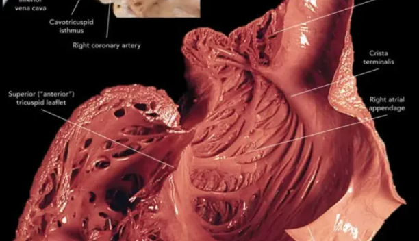 心律解码丨心房扑动的心电图特点及治疗