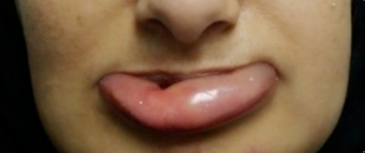 根管治疗，竟然转去ICU，原因在这！可能你也在用